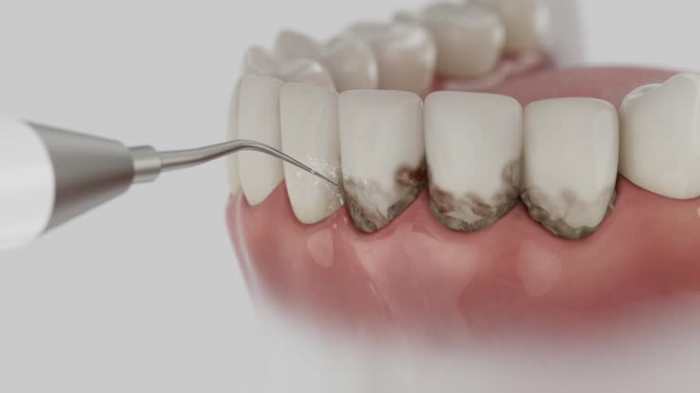 Reliable Dental contractor in Clearwater, MN by Dentist Open Now